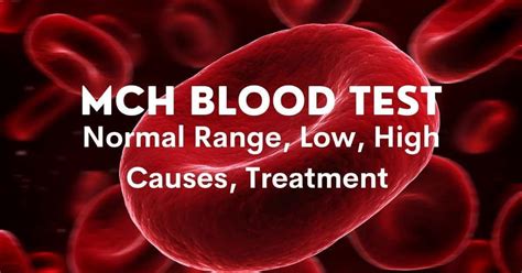 MCH levels in complete blood count tests: High and low levels.